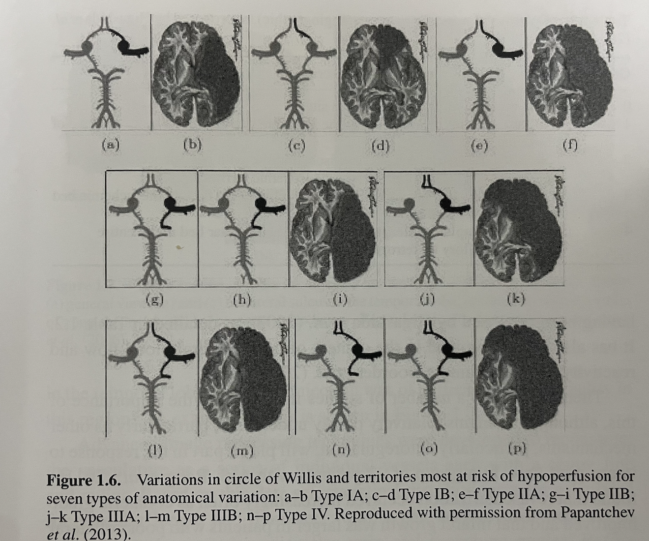Cerebral Circulation & composition