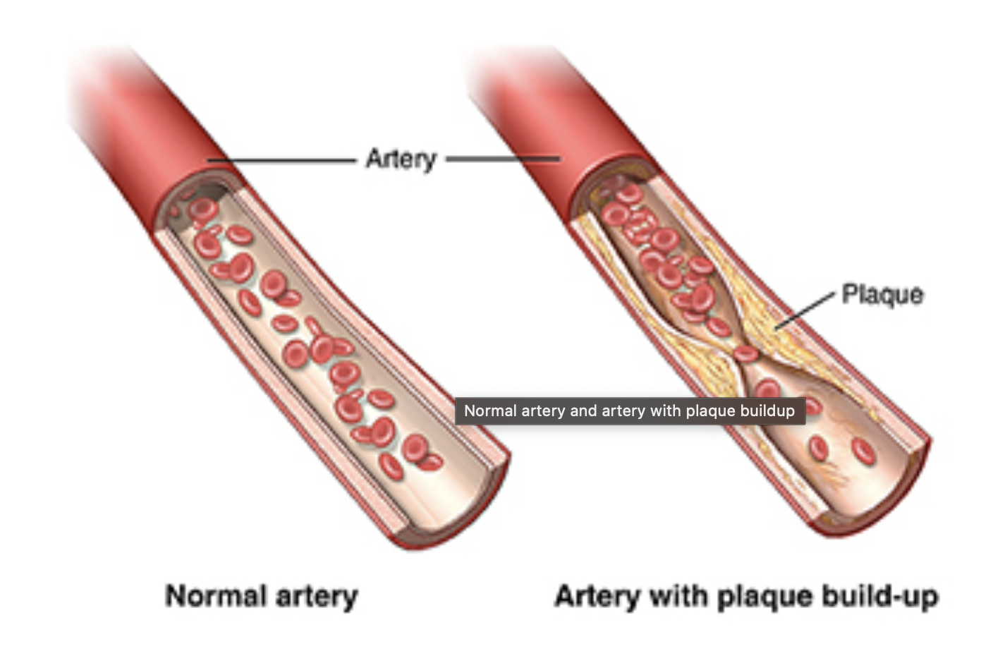 Cerebral Circulation & composition