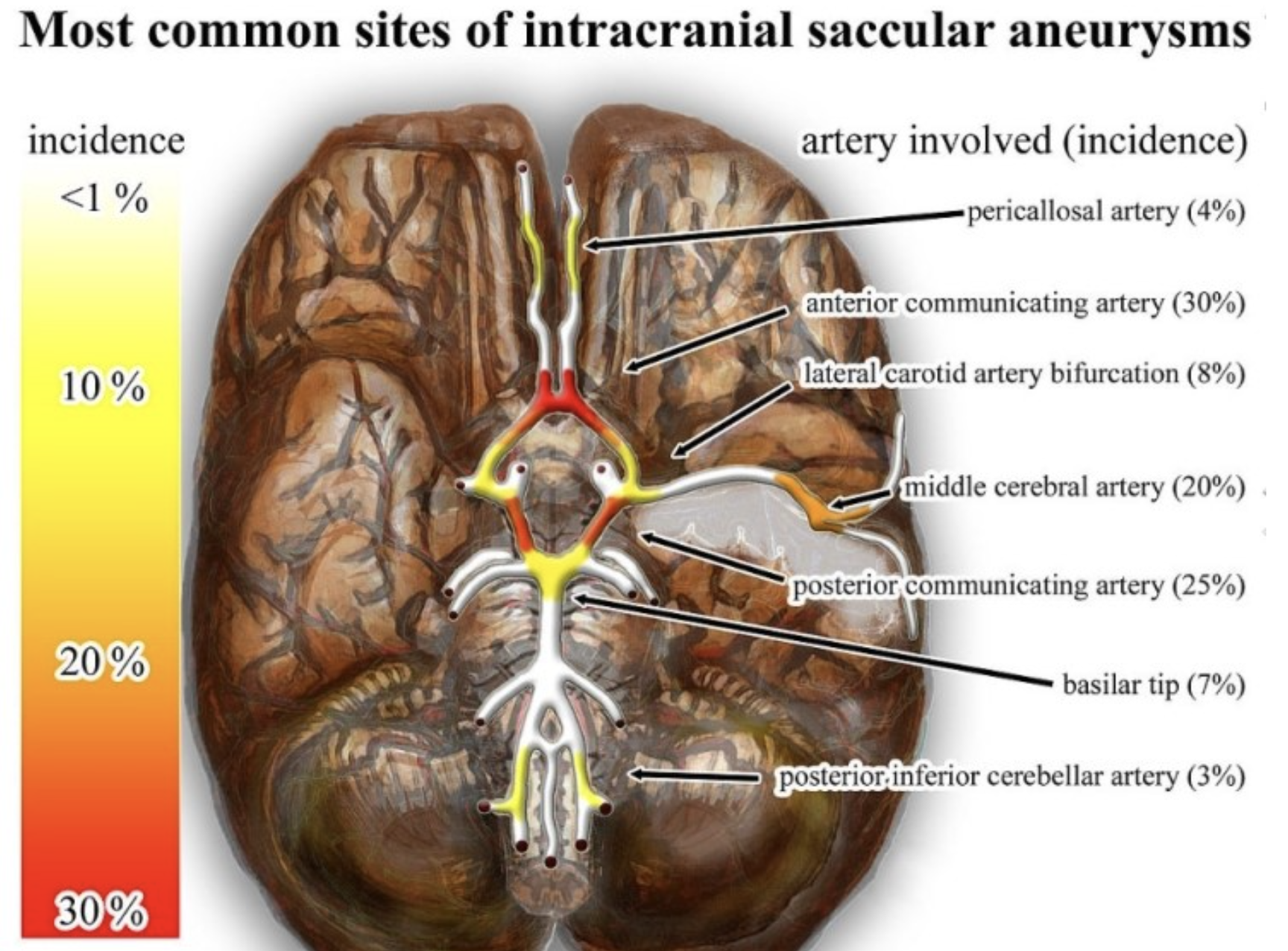 [Cardiovascular disease] Aneurysm _ part1