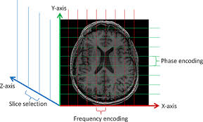 [Cardiovascular disease] Aneurysm _ part2_MRA