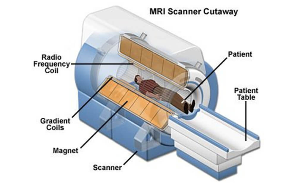 [Cardiovascular disease] Aneurysm _ part2_MRI