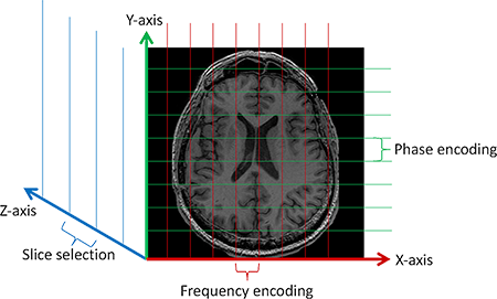 [Cardiovascular disease] Aneurysm _ part2_MRI