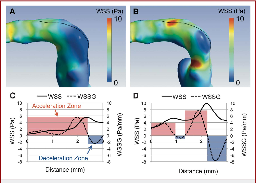 [Cardiovascular disease] Aneurysm _ part3