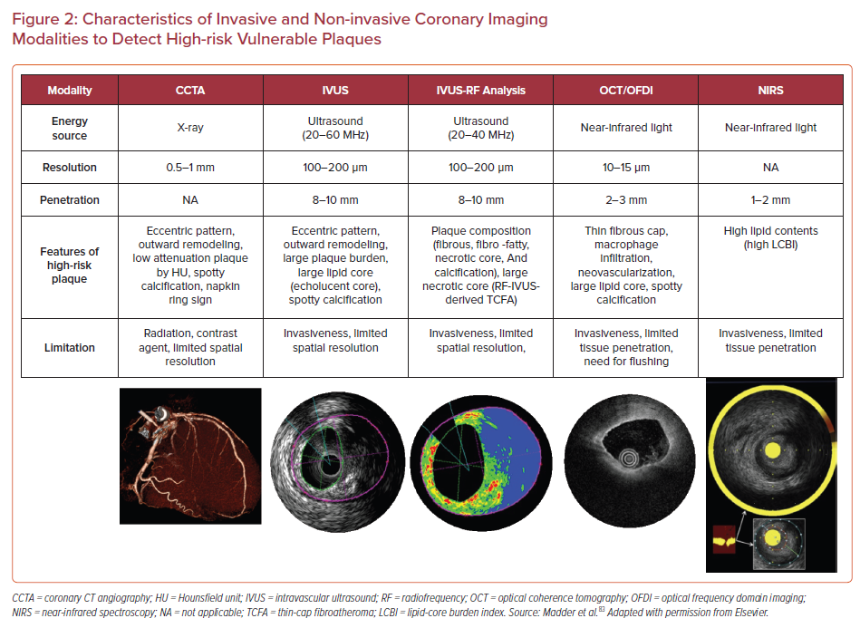 Calcification on Coronary Artery - Plaque composition 1